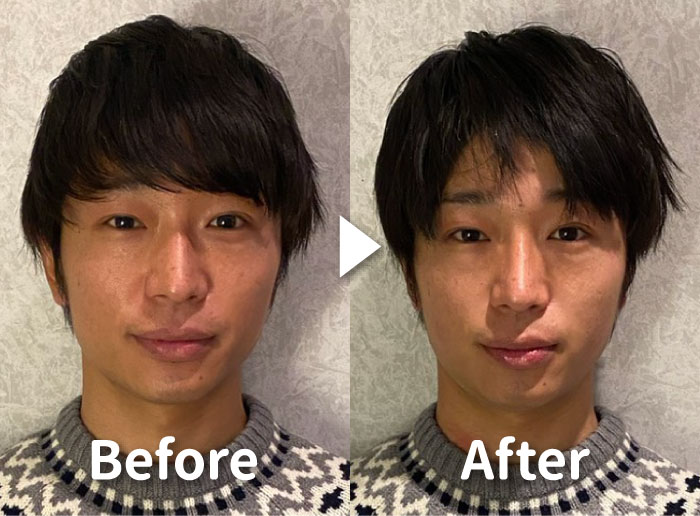 Before After -05